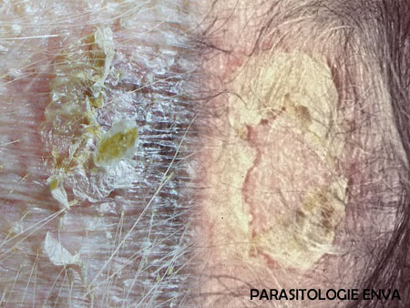 collerettes epidermiques Photo Benjamin Bayon / UP parasito/dermato ENVA.