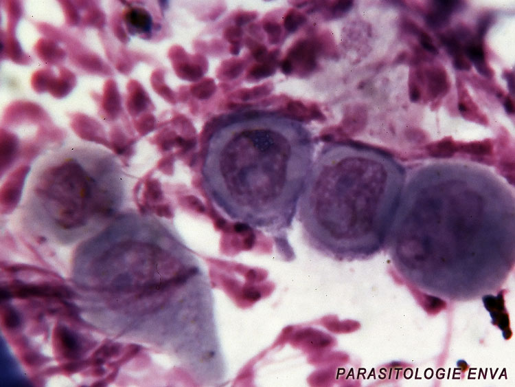 acanthocytes