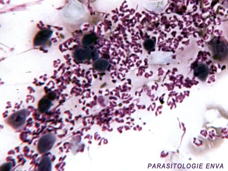 acantholyse