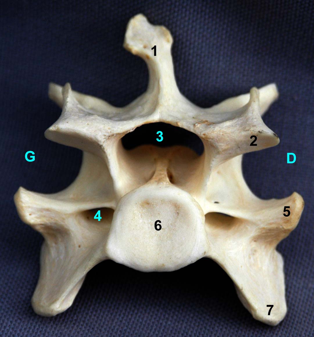 Vertèbre cervicale VI de chien vue caudale