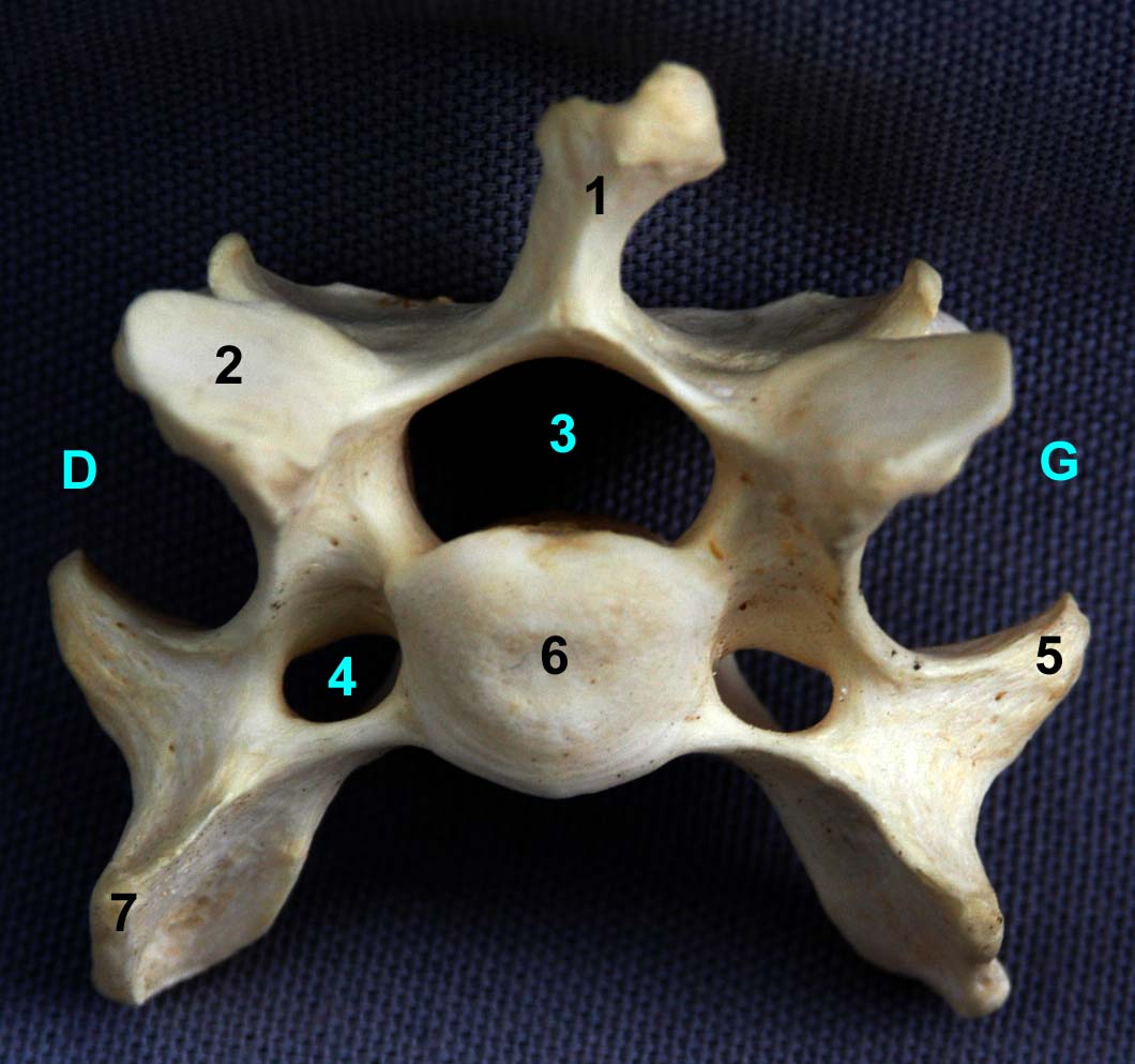 Vertèbre cervicale VI de chien vue crâniale