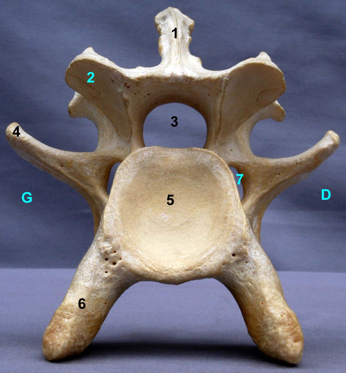 Vertèbre cervicale VI de bovin vue caudale