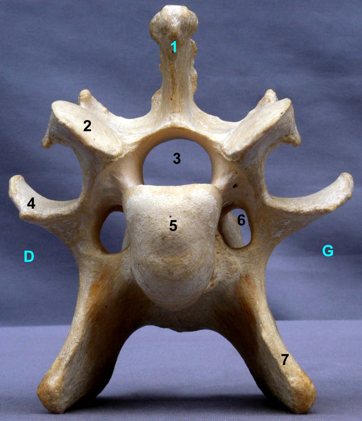 Vertèbre cervicale VI de bovin vue crâniale