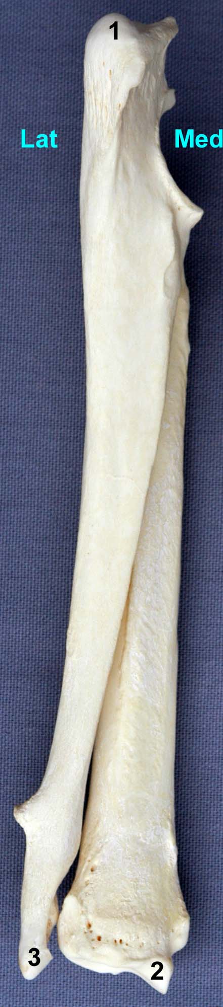 radius-ulna de chien vue palmaire