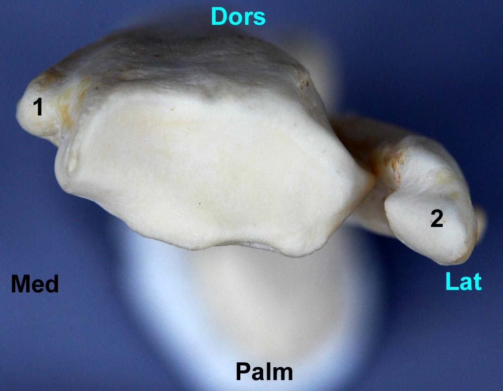 radius-ulna de chien vue distale