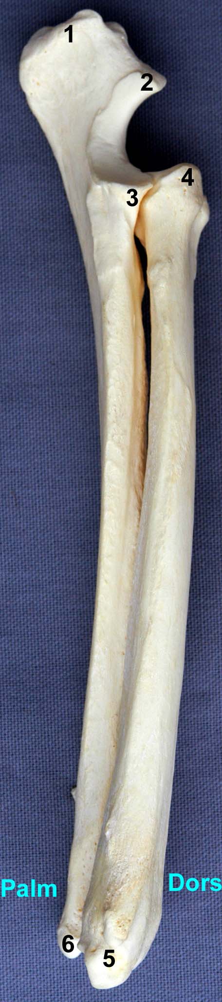 radius-ulna de chien vue médiale