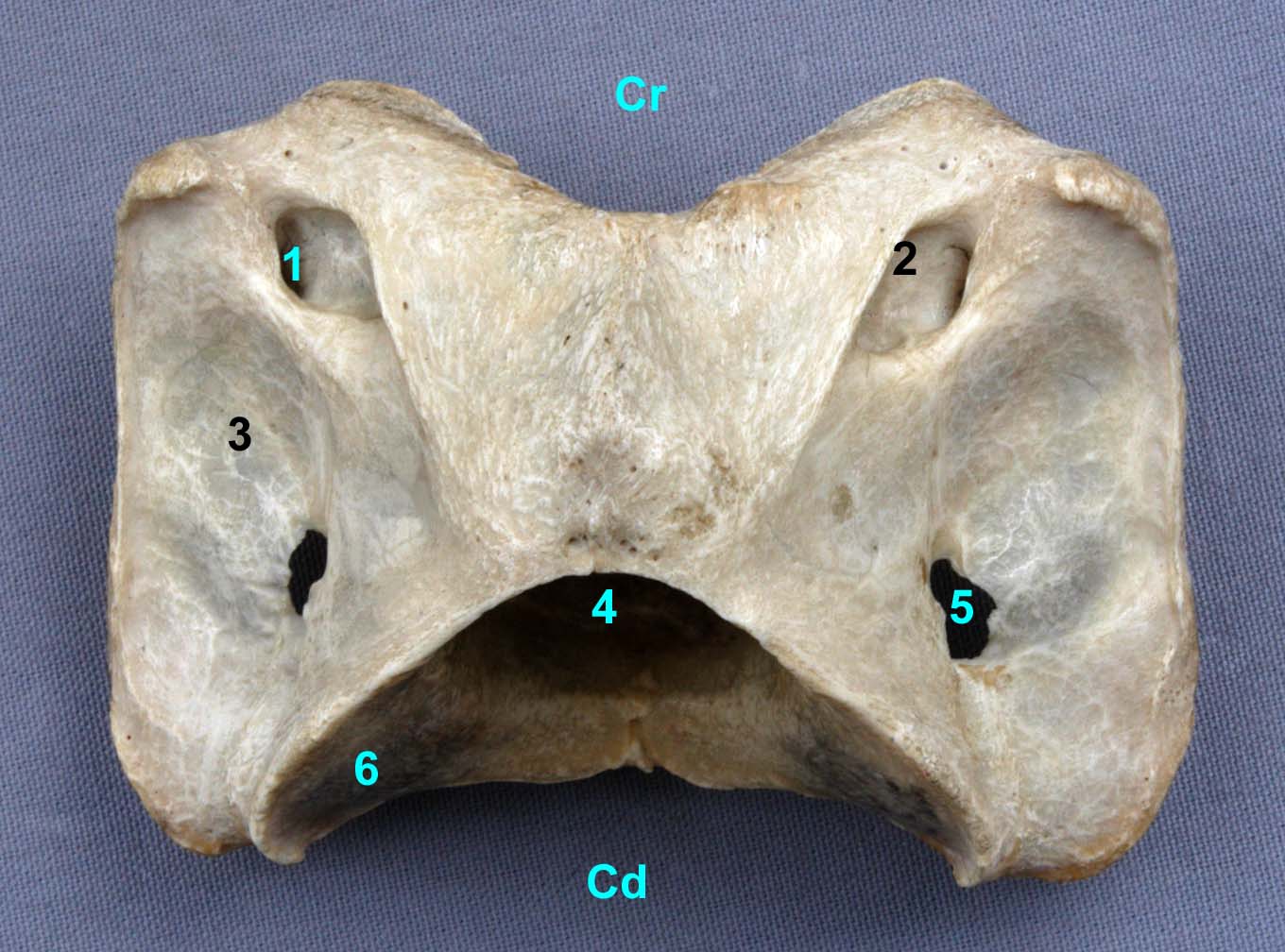 Atlas de cheval vue dorsale