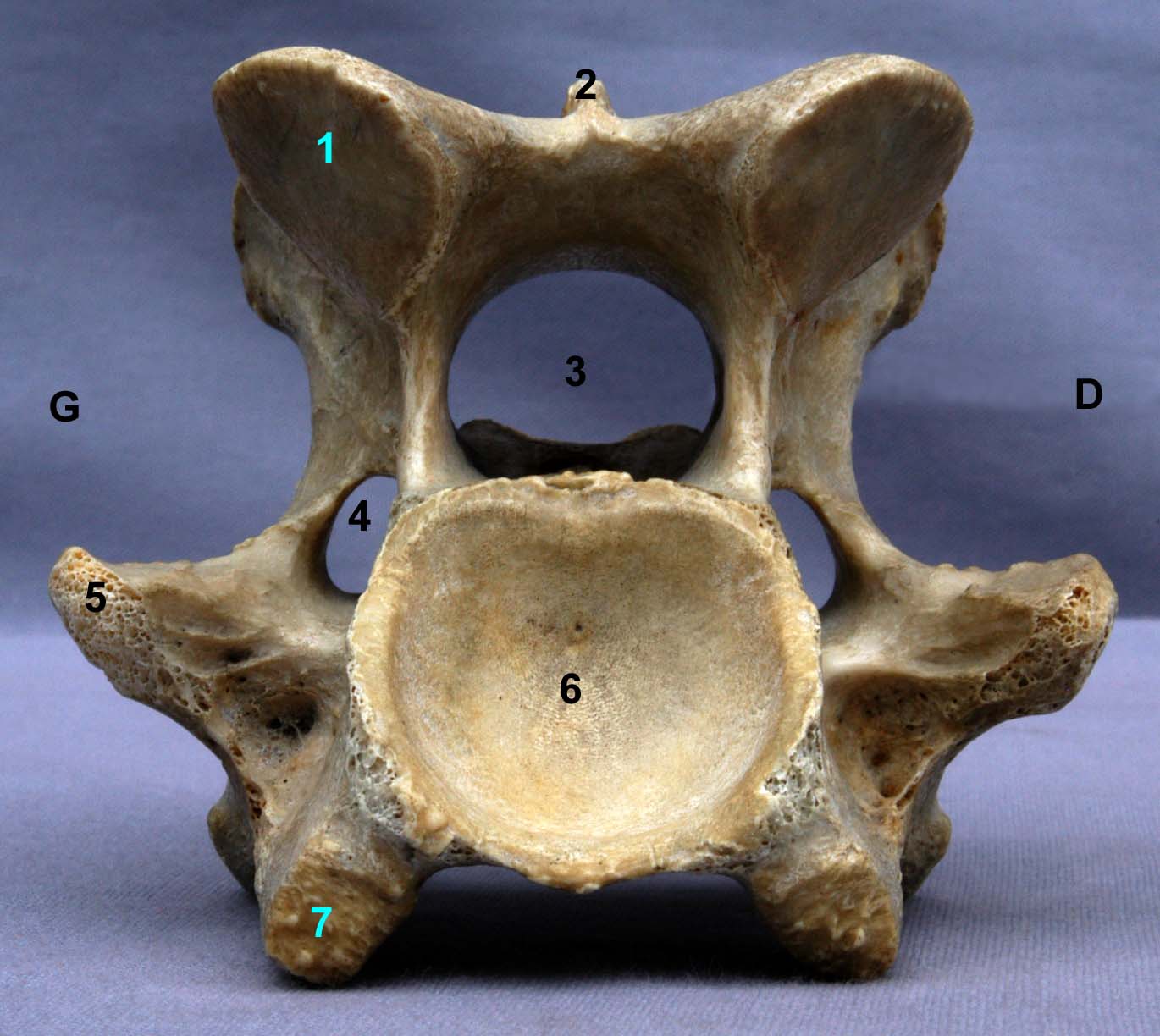Vertèbre cervicale VI de cheval vue caudale