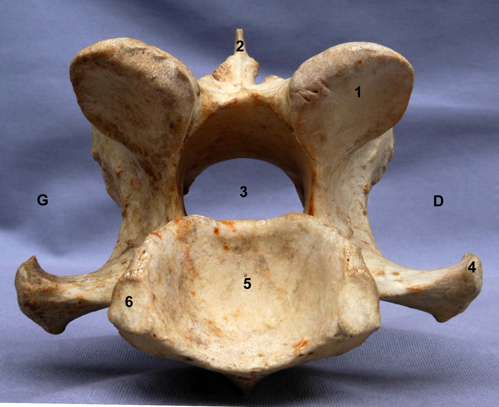 Vertèbre cervicale VII de cheval vue caudale