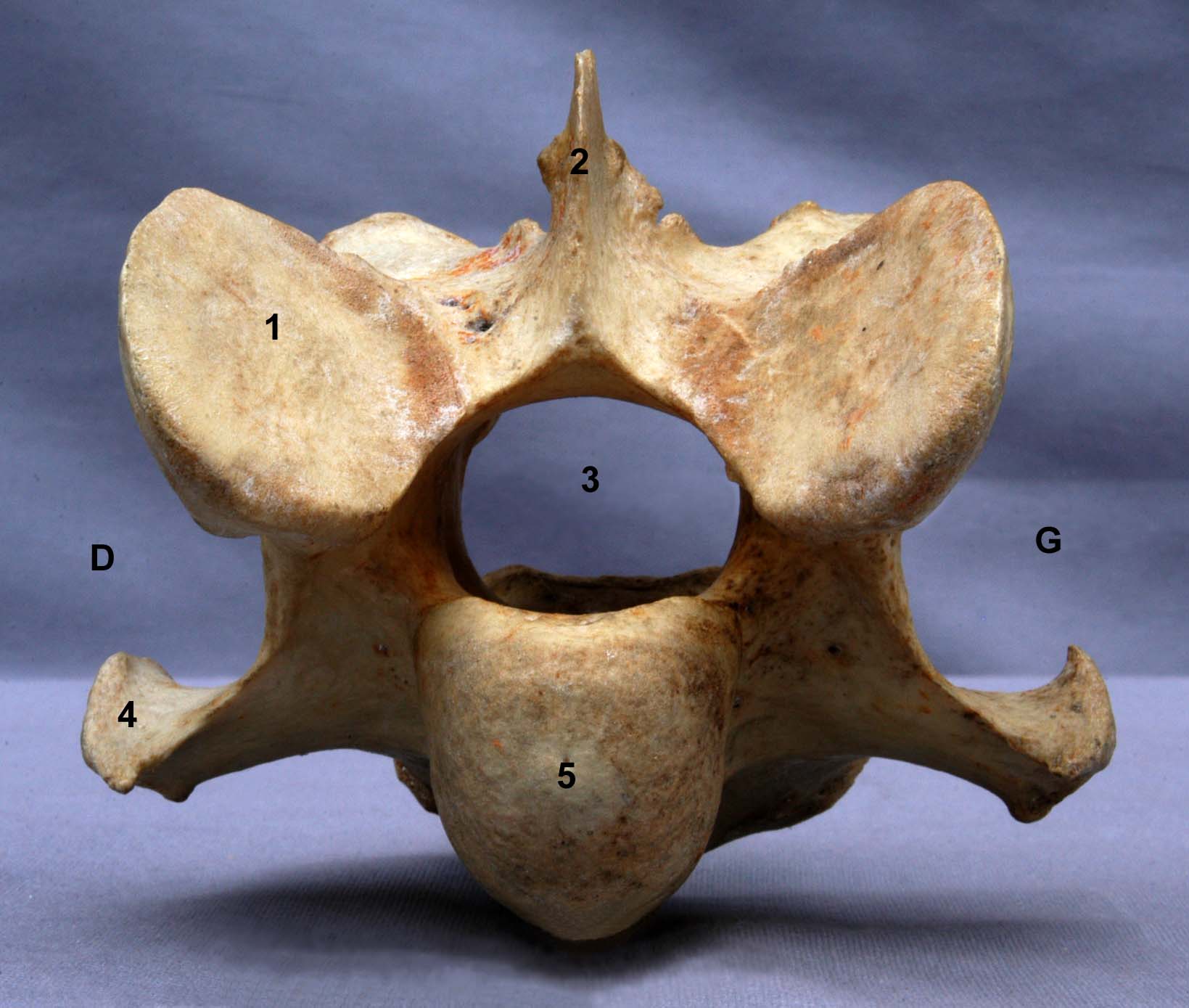 Vertèbre cervicale VII de cheval vue crâniale