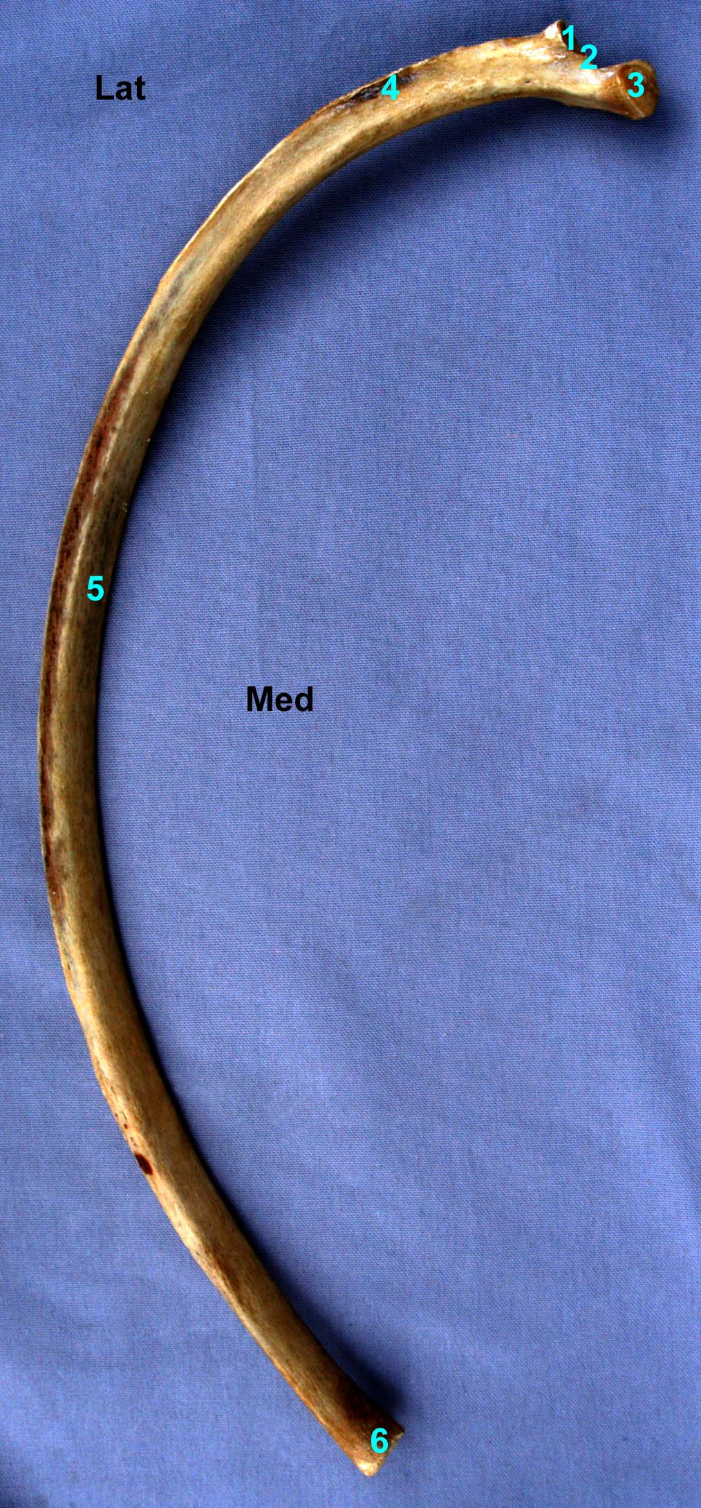 côte de cheval vue médio-caudale