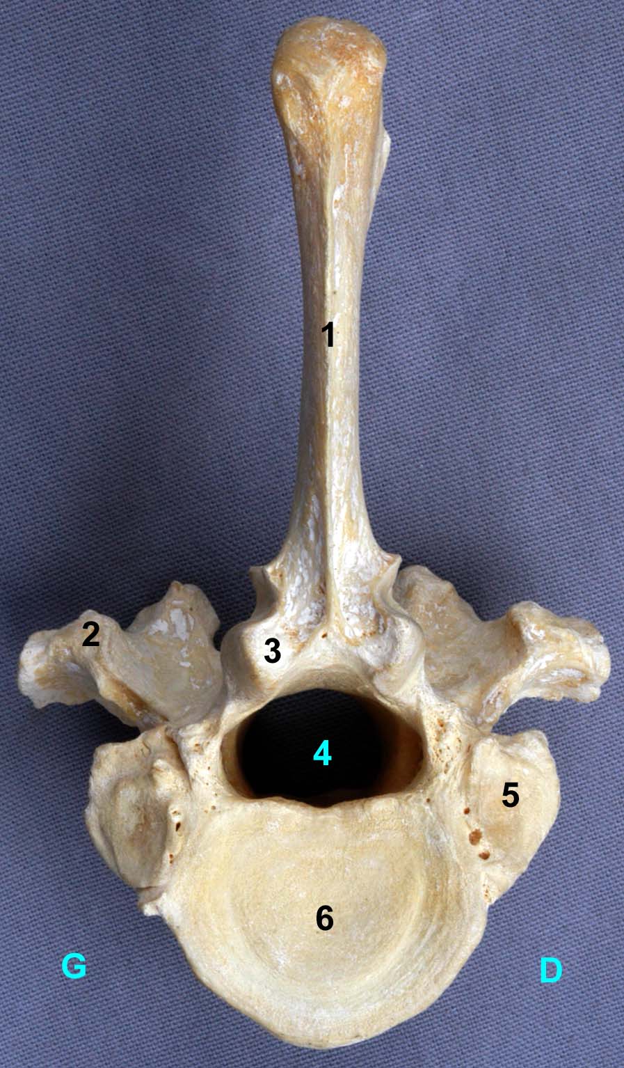vertèbre thoracique XIII de bovin vue caudale