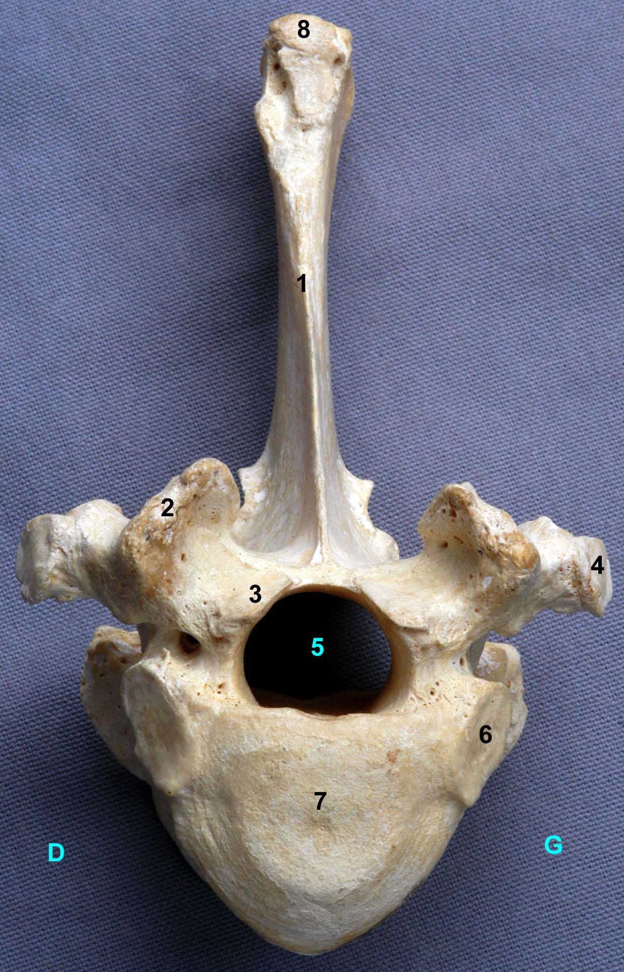 vertèbre thoracique XIII de bovin vue crâniale