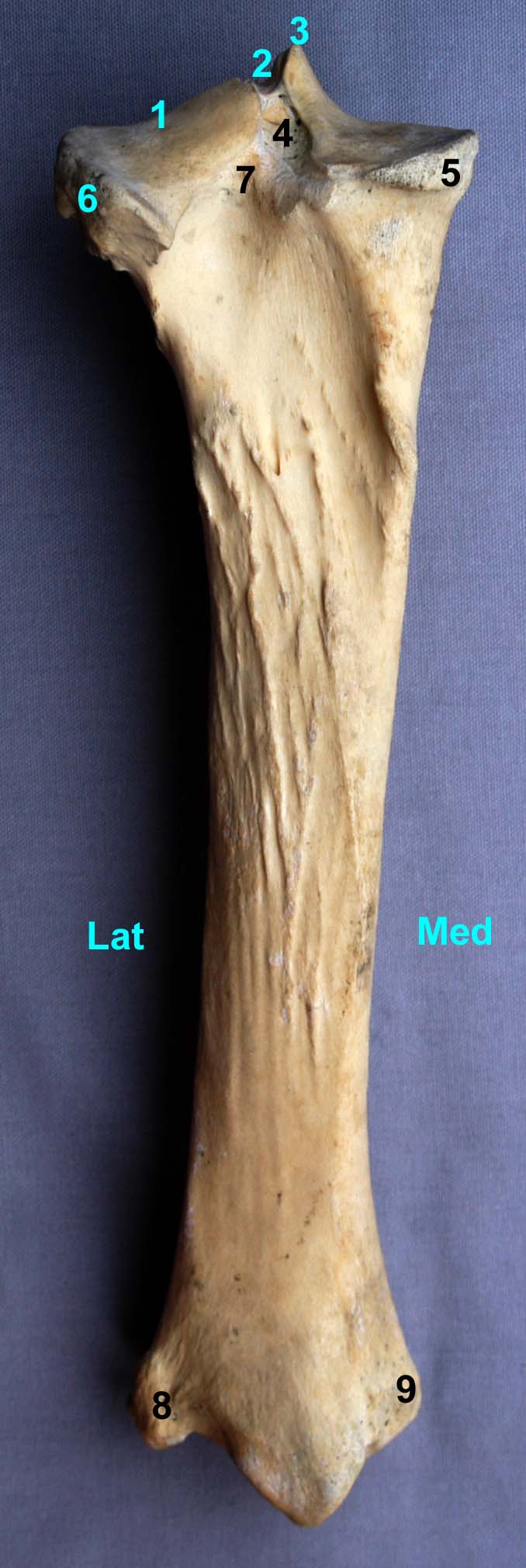 tibia de cheval vue caudale