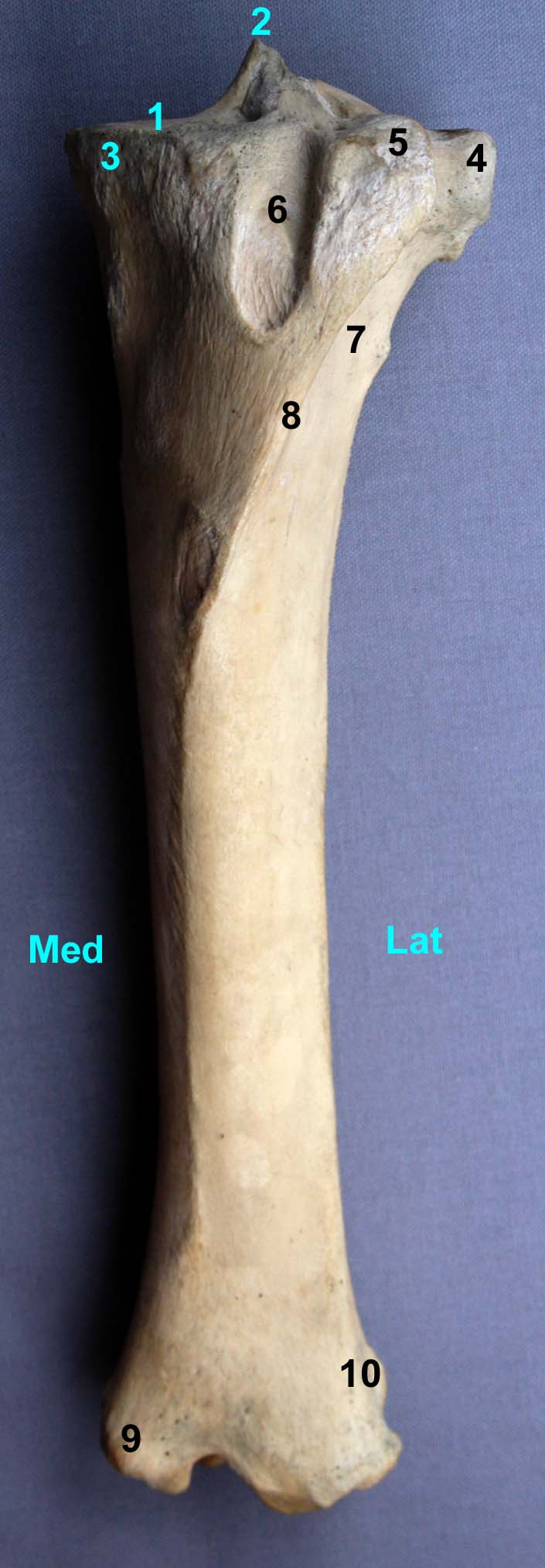 tibia de cheval vue crâniale