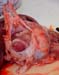 pericardite enterotox stage2