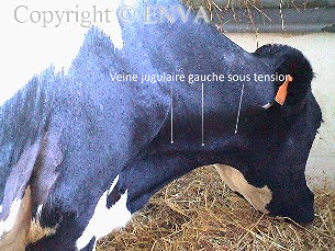 ponction du pericarde