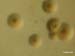 myco_myco_large_col_exopol2