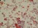 mycoplasma_agalactiae_exopol