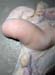 uterus_monocorne_ov (3)