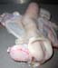 uterus_monocorne_ov (5)