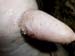 boutons_trayon_ov