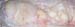 kystes_lactes_gros_plan_ov