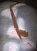 avortement_torsion_cordon (1)