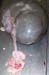 avortement_torsion_cordon (3)