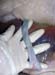 comparaiso_ avortement_torsion_cordon (2)