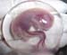 foetus_enveloppes_ov