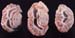 hydrocephalie_bluetongue_ov_ceva