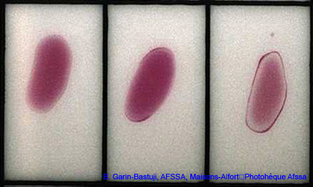 epreuve_antigene_tamponne2