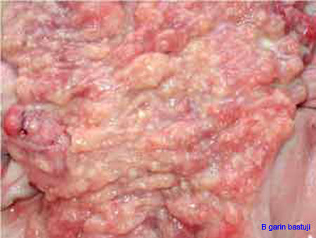 metrite_brucella