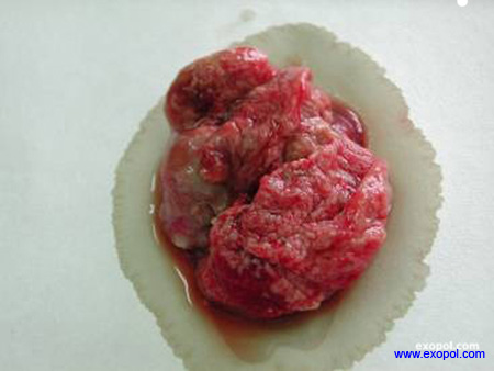 campylobacter_exopol2