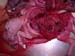 suspicion_avort_chlam_ov_ginie (10)