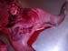 suspicion_avort_chlam_ov_ginie (13)