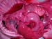 suspicion_avort_chlam_ov_ginie (14)