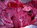 suspicion_avort_chlam_ov_ginie (15)