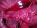 suspicion_avort_chlam_ov_ginie (17)