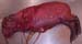 suspicion_avort_chlam_ov_ginie (18)