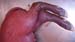 suspicion_avort_chlam_ov_ginie (3)