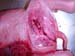 suspicion_avort_chlam_ov_ginie (5)