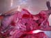 suspicion_avort_chlam_ov_ginie (9)