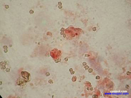 coxiella_burnetti_exopol
