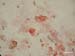 coxiella_burnetti_exopol
