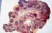 ov_placenta_avortement_rickettsia (1)