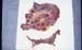 ov_placenta_avortement_rickettsia