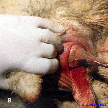 anneau_cervical_ceva