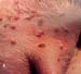 ecthyma_contagieux_ov_ceva